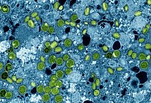 Mpox - -/NIAID via AP/dpa