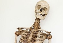 Rätsel um Schinderhannes-Skelett gelöst - Sara Doll/Medizinische Fakultät Heidelberg/dpa