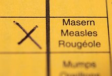 Masern - Tom Weller/dpa