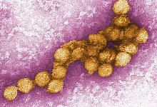 West-Nil-Virus - Foto: Cynthia Goldsmith/Centers For Disease Control/EPA