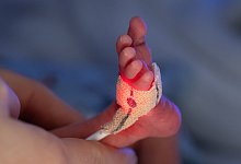 Frühchen werden ins Leben begleitet - Boris Roessler/dpa