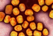 Affenpockenvirus - Niaid/Niaid/Planet Pix via ZUMA Press Wire/dpa