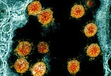 Mikroskopische Aufnahme des Coronavirus - Foto: Uncredited/NIAID/NIH/dpa