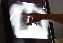 Schlichtungsstelle für Arzthaftpflichtfragen - Susann Prautsch/dpa/dpa-tmn