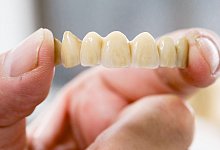 Zahntechniklabor in L&uuml;beck - Markus Scholz/dpa-tmn