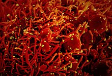 Coronavirus - Foto: Niaid/Europa Press/dpa