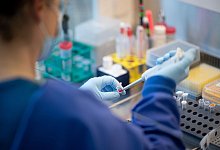 Bei der aktuell hohen Positivrate bei PCR-Tests muss auch von einer hohen Dunkelziffer ausgegangen werden. - Daniel Reinhardt/dpa