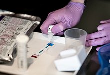 HIV-Schnelltest - Foto: Fabian Sommer/dpa