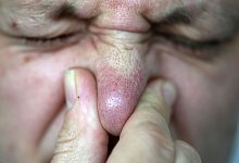 Das Pups-Problem im Flieger - Oliver Berg/dpa