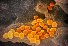 Coronavirus unter dem Mikroskop - Foto: NIAID-RML/AP/dpa