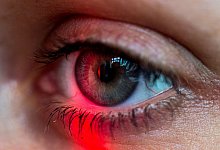 Ein roter Lichtschein liegt über einem Auge - Henrik Josef Boerger/dpa/dpa-tmn