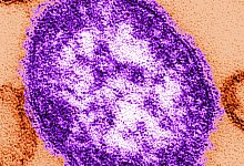 Masern - Cynthia Goldsmith/Centers for Disease Control and Prevention/dpa