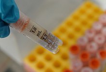 Stuhlprobe - Christiane Oelrich/dpa