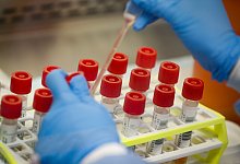 Im Labor - Foto: John Minchillo/AP/dpa