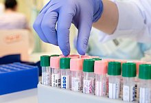 PCR-Labor - Foto: Sebastian Kahnert/dpa-Zentralbild/dpa