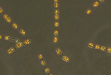 Kieselalge Skeletonema marinoi - S. Bolius/Iow/dpa