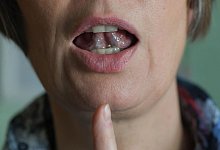 Die wichtigsten Fragen und Antworten zum Welttag des Stotterns - Jens Kalaene/zb/dpa