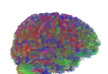 Kindheit bis Alter – Gehirnstruktur durchläuft fünf Phasen - Dr Alexa Mousley/University of Cambridge/dpa