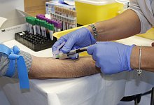 Antik&ouml;rpertest - Symbolfoto: pixabay.com/Antonio Corigliano