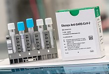 Antik&ouml;rpertest Elecsys - Foto: Peter Kneffel/dpa