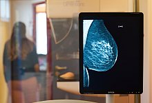 Fr&uuml;herkennung: Wie Mediziner Brustkrebs rechtzeitig entdecken - Klaus-Dietmar Gabbert/dpa-Zentralbild/dpa-tmn