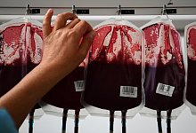 Medizin-Nobelpreis an Entdecker von Hepatitis-C-Virus - Foto: Ina Fassbender/dpa