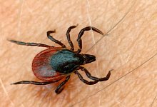 Zeckenstiche - Foto: Patrick Pleul/dpa