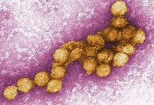 West-Nil-Virus - Foto: Cynthia Goldsmith/CENTERS FOR DISEASE CONTROL
