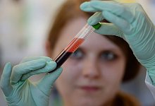 Bluttest auf Trisomien - Patrick Seeger/dpa/dpa-tmn