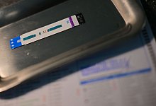 HIV-Test - Sebastian Gollnow/dpa