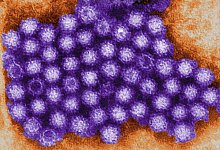 Ein digital eingef&auml;rbtes transmissionselektronenmikroskopisches (TEM) Bild zeigt ein Cluster von Noroviren. - Charles D. Humphre/CDC/dpa