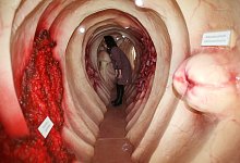 Begehbares Darm-Modell - Foto: Bodo Schackow