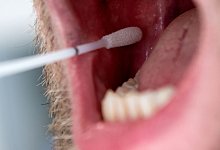 DNA-Test zur Ahnenforschung - Sven Hoppe/dpa