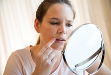 Lippenherpes - Christin Klose/dpa-tmn/dpa