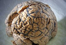 Menschliches Gehirn - Jan-Peter Kasper/dpa-Zentralbild/dpa