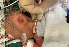 rashkind_verpixelt-1 - HDZ NRW