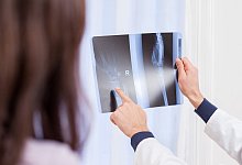 Gericht: Arzt darf Befund von Fachkollegen vertrauen - picture alliance/dpa/dpa-tmn