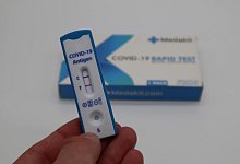 Nach einem positiven Testergebnis kann es derzeit l&auml;nger dauern, bis sich das Gesundheitsamt meldet. - Unsplash (Symbolfoto)