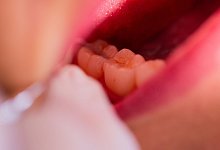 Zahnarztpraxis - Rolf Vennenbernd/dpa