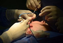 Sch&ouml;nheitsoperation - Foto: Georg Ismar/dpa