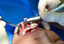 Kind beim Zahnarzt - Patrick Pleul/dpa-Zentralbild/dpa