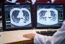 Wie es Patienten nach Covid-19 geht - Sebastian Gollnow/dpa