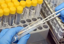 PCR-Tests - Foto: Waltraud Grubitzsch/dpa