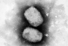 Affenpocken - Foto: Andrea M&auml;nnel/RKI/dpa