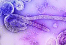 Marburgvirus - Dr. Frederick Murphy/CDC/dpa