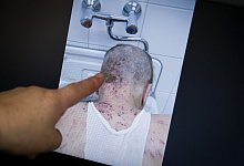 Kr&auml;tze - Foto: Daniel Naupold