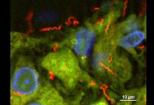 Syphilis - Foto: PD Dr. Annette Moter/Charite-Universit&auml;tsmedizin Berlin/dpa