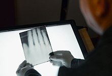 R&ouml;ntgens Bilder - Marius Becker/dpa