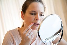 Lippenherpes - Christin Klose/dpa-tmn