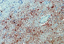 T&ouml;dlicher Borna-Virus - Bernhard-Nocht-Institut f&uuml;r Tropenmedizin/dpa